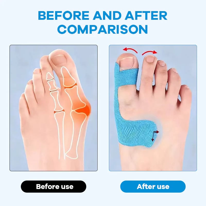 Hallux Valgus Relief Tape 👣 | Comfortable Toe Alignment Support for Daily Walking & Foot Care