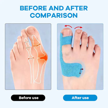Hallux Valgus Relief Tape 👣 | Comfortable Toe Alignment Support for Daily Walking & Foot Care