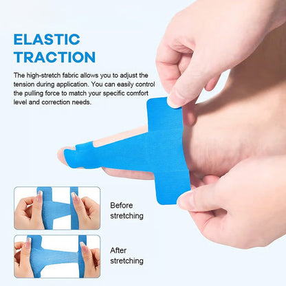 Hallux Valgus Relief Tape 👣 | Comfortable Toe Alignment Support for Daily Walking & Foot Care